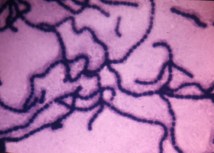 streptococcusgramstain2